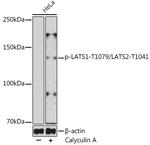 Phospho-LATS1/LATS2 (Thr1079, Thr1041) Antibody in Western Blot (WB)
