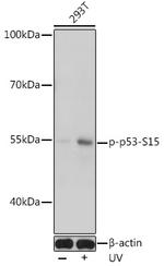 Phospho-p53 (Ser15) Antibody in Western Blot (WB)