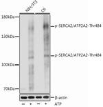 Phospho-SERCA2 ATPase (Thr484) Polyclonal Antibody