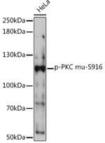 Phospho-PKC mu (Ser916) Polyclonal Antibody