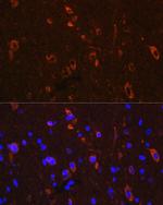 Phospho-Tau (Ser416) Antibody in Immunohistochemistry (Paraffin) (IHC (P))