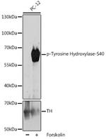 Phospho-Tyrosine Hydroxylase (Ser40) Polyclonal Antibody