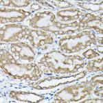 Phospho-K-Ras (Ser89) Polyclonal Antibody