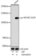Phospho-MCM2 (Ser139) Antibody in Western Blot (WB)