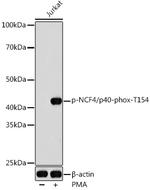 Phospho-NCF4 (Thr154) Polyclonal Antibody