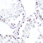 Phospho-AMPK beta-1 (Ser182) Antibody in Immunohistochemistry (Paraffin) (IHC (P))