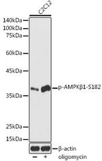 Phospho-AMPK beta-1 (Ser182) Antibody in Western Blot (WB)