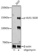 Phospho-ULK1 (Ser638) Polyclonal Antibody