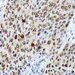 Phospho-FOXO3A (Ser425) Polyclonal Antibody
