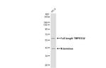 TMPRSS2 Antibody in Western Blot (WB)