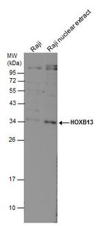 HOXB13 Polyclonal Antibody