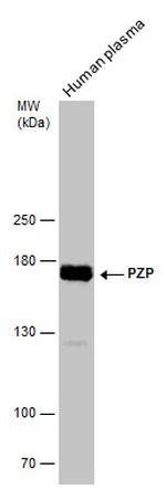 PZP Polyclonal Antibody