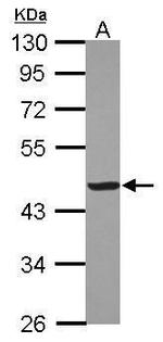 Creatine Kinase MM Polyclonal Antibody