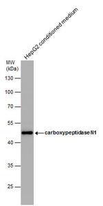CPN1 Antibody in Western Blot (WB)