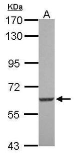 SGK3 Polyclonal Antibody