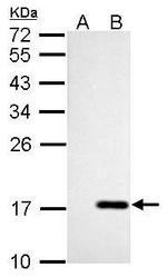 NME4 Polyclonal Antibody