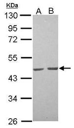 ACTA1 Antibody in Western Blot (WB)