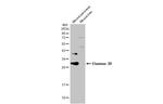CELA3B Antibody in Western Blot (WB)