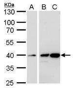 Calponin 3 Polyclonal Antibody