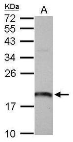 ARL1 Antibody in Western Blot (WB)