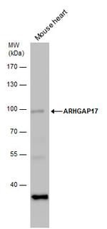 ARHGAP17 Polyclonal Antibody