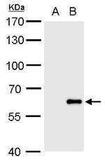 Influenza B Virus Polyclonal Antibody