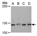 XPF Polyclonal Antibody