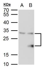 SMUG1 Polyclonal Antibody