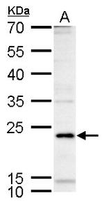 ICOS Antibody in Western Blot (WB)