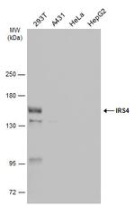 IRS4 Antibody in Western Blot (WB)