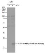 Hepatitis C Virus Core Antigen Polyclonal Antibody