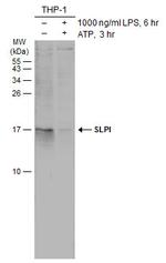 SLPI Polyclonal Antibody
