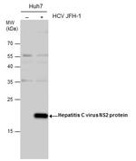 Hepatitis C Virus NS2 Antibody in Western Blot (WB)
