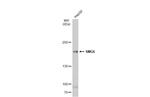SMG6 Polyclonal Antibody