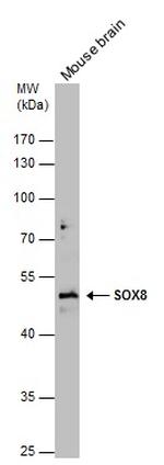 SOX8 Polyclonal Antibody