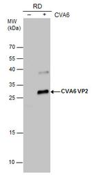 Coxsackievirus A6 VP2 Polyclonal Antibody
