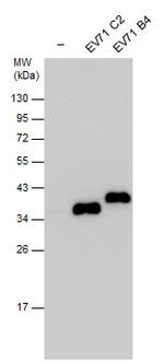 Enterovirus 71 VP1 Polyclonal Antibody