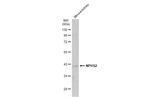 NPHS2 Polyclonal Antibody