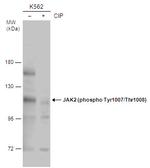 Phospho-JAK2 (Tyr1007, Tyr1008) Polyclonal Antibody