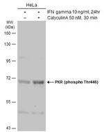 Phospho-PKR (Thr446) Antibody in Western Blot (WB)