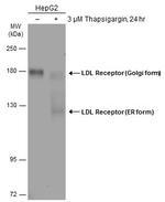 LDL receptor Polyclonal Antibody