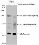 LDL receptor Polyclonal Antibody