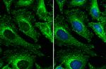 Clathrin Heavy Chain Polyclonal Antibody