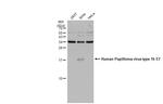HPV Type 16 E7 Polyclonal Antibody