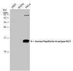 HPV Type 18 E7 Antibody in Western Blot (WB)