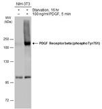 Phospho-PDGF Receptor beta (Tyr751) Antibody in Western Blot (WB)