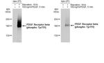 Phospho-PDGF Receptor beta (Tyr751) Antibody in Western Blot (WB)
