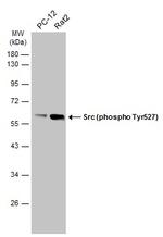 Phospho-SRC (Tyr527) Antibody in Western Blot (WB)