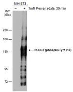 Phospho-PLCG2 (Tyr1217) Polyclonal Antibody