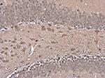 HuD Polyclonal Antibody